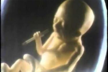 American Cancer Society - Smoking Fetus (1984, USA)